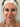 A woman's face ready for skin treatment