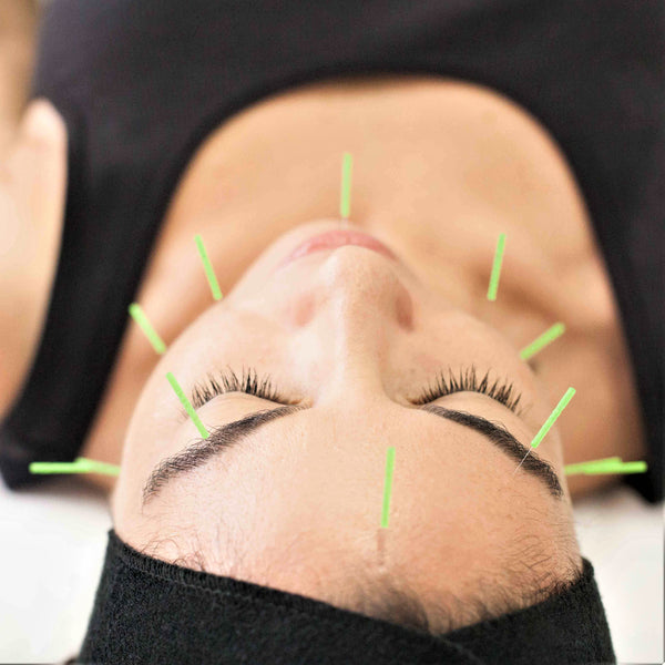 FIVE FACTS ACUPUNCTURE AND INJECTABLES